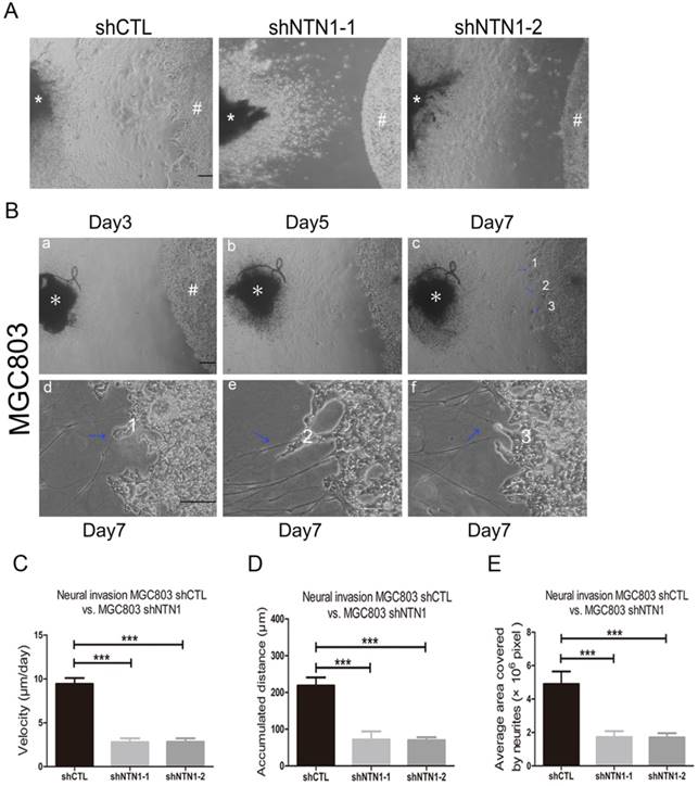 J Cancer Image