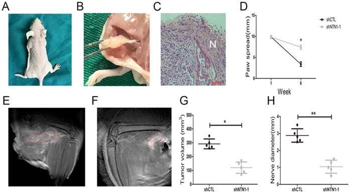 J Cancer Image