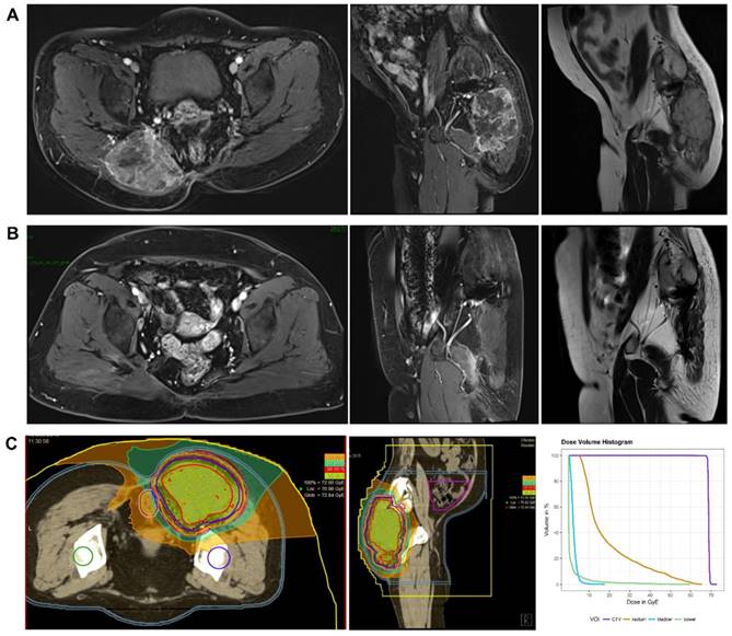 J Cancer Image