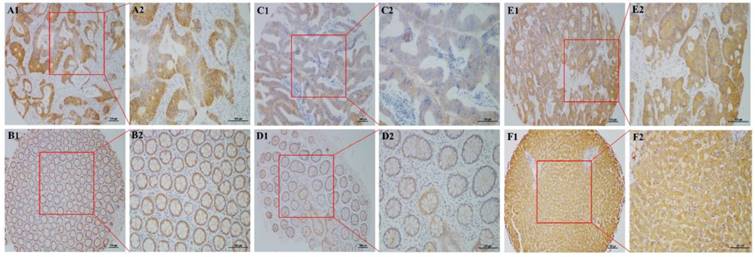 J Cancer Image