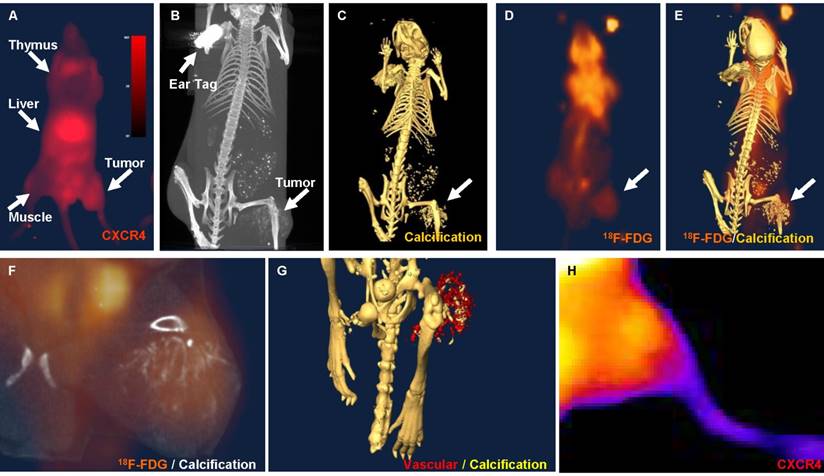 J Cancer Image