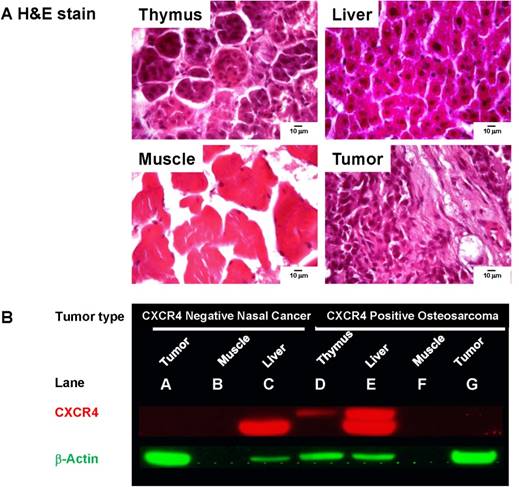 J Cancer Image