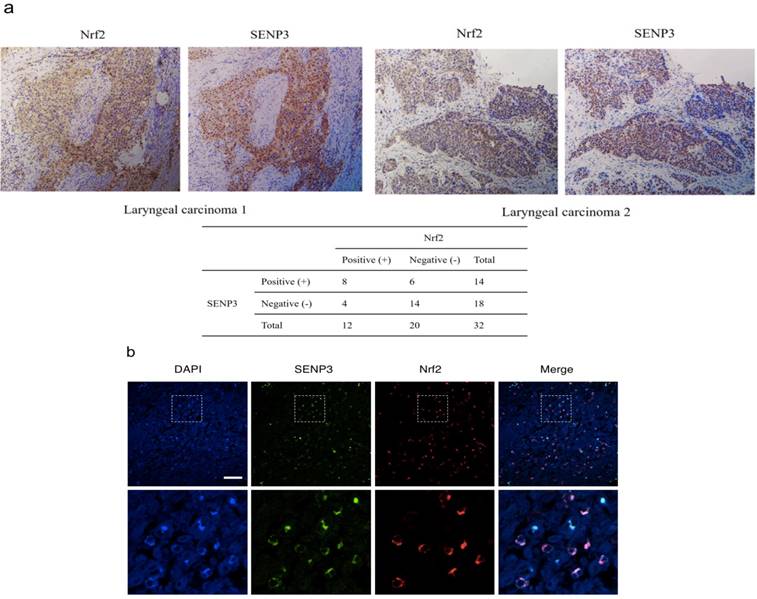 J Cancer Image