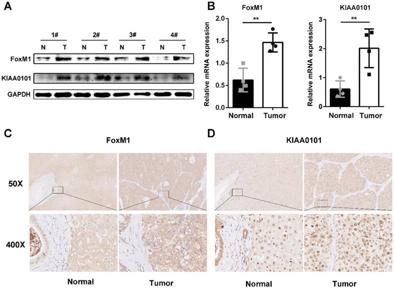 J Cancer Image