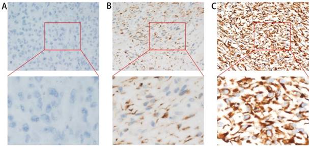 J Cancer Image