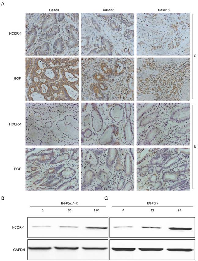 J Cancer Image