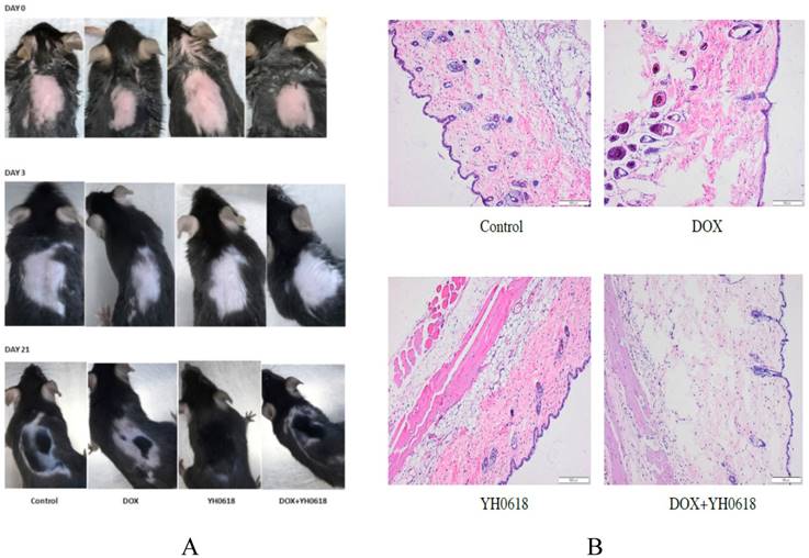 J Cancer Image