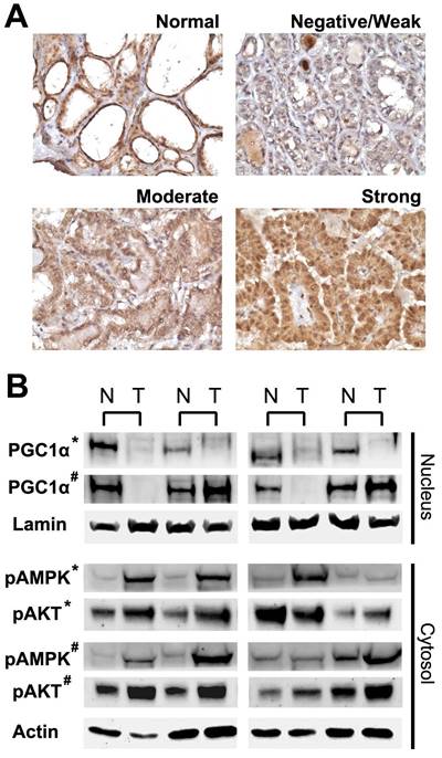 J Cancer Image