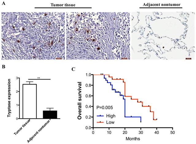 J Cancer Image