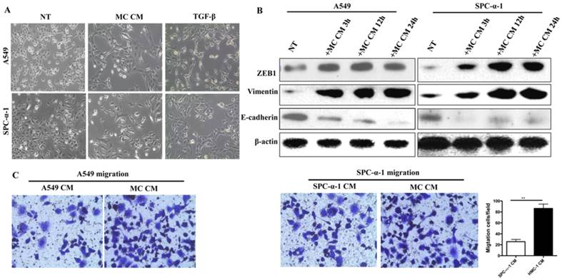 J Cancer Image