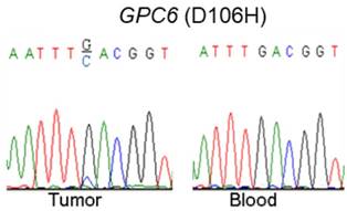 J Cancer Image