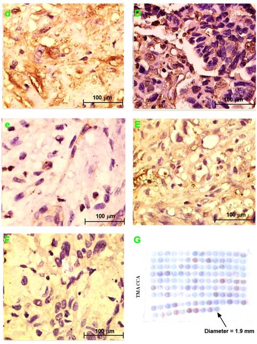 J Cancer Image