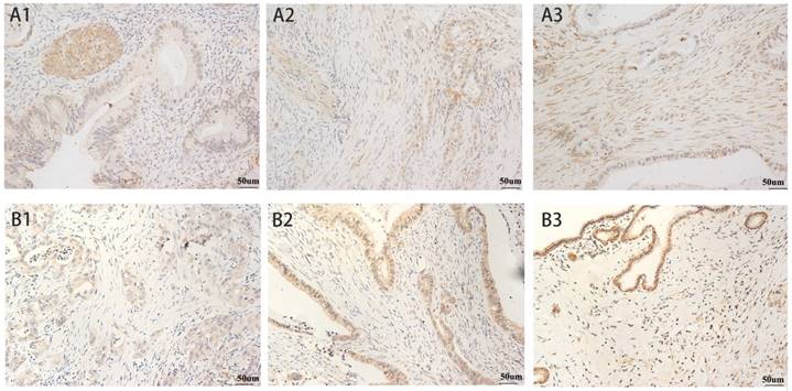 J Cancer Image