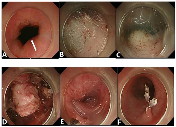 J Cancer Image