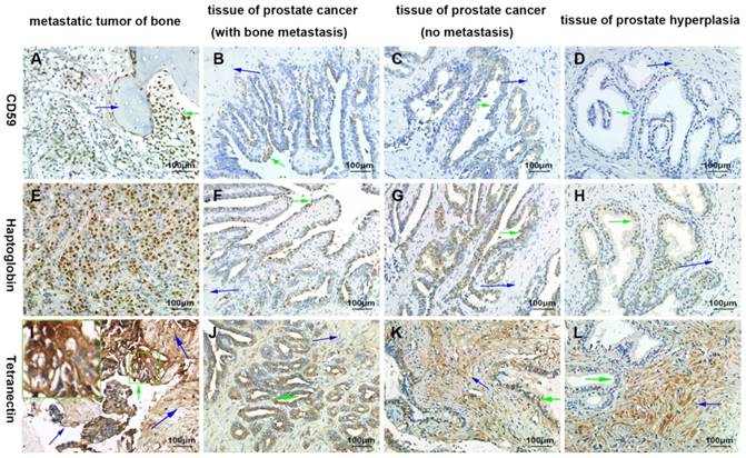 J Cancer Image