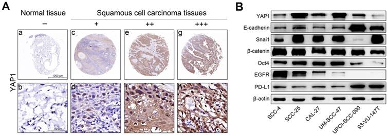 J Cancer Image