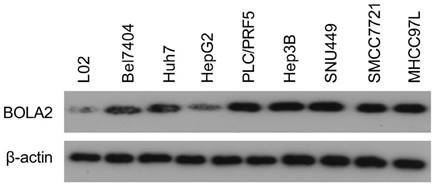 J Cancer Image