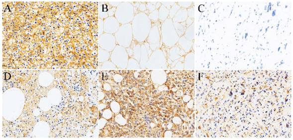 J Cancer Image