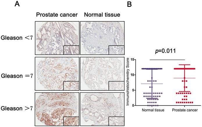 J Cancer Image