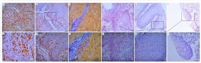 J Cancer Image