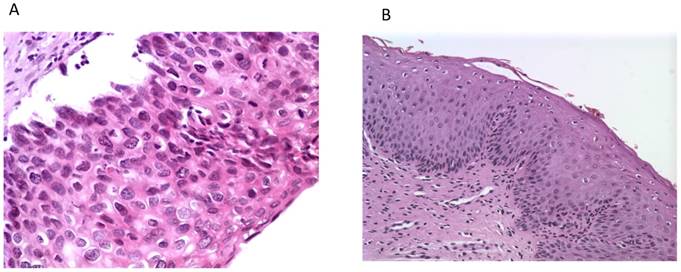 J Cancer Image