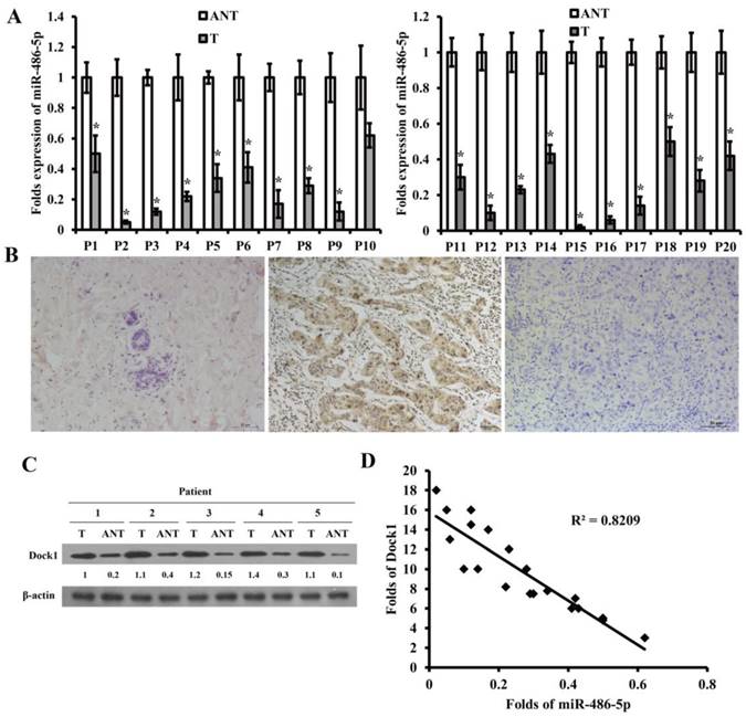 J Cancer Image