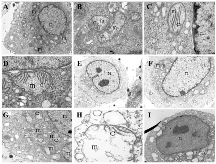 J Cancer Image