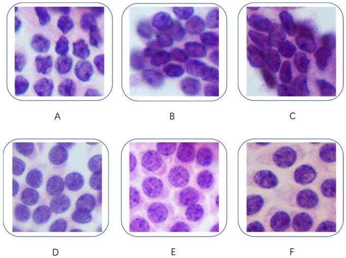 J Cancer Image