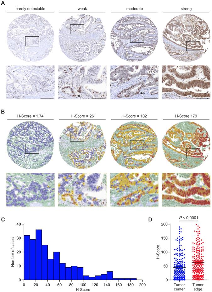 J Cancer Image