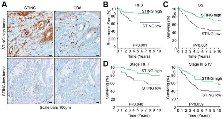 J Cancer Image