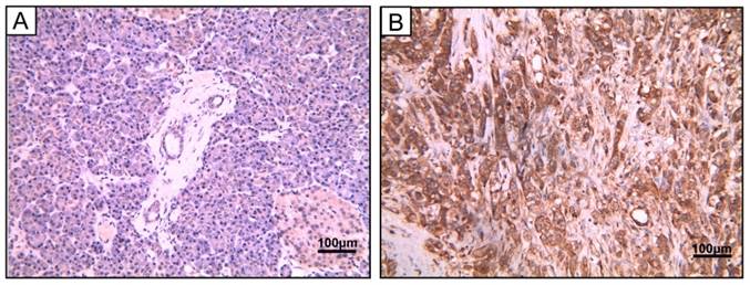 J Cancer Image