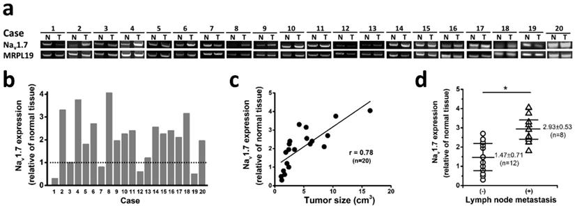 J Cancer Image