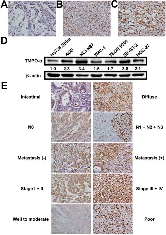 J Cancer Image