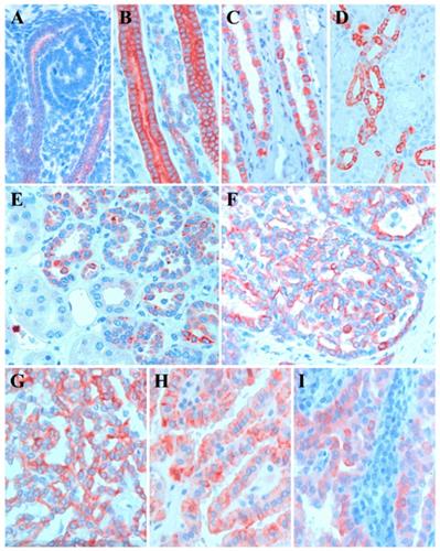 J Cancer Image