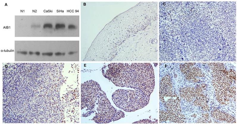 J Cancer Image