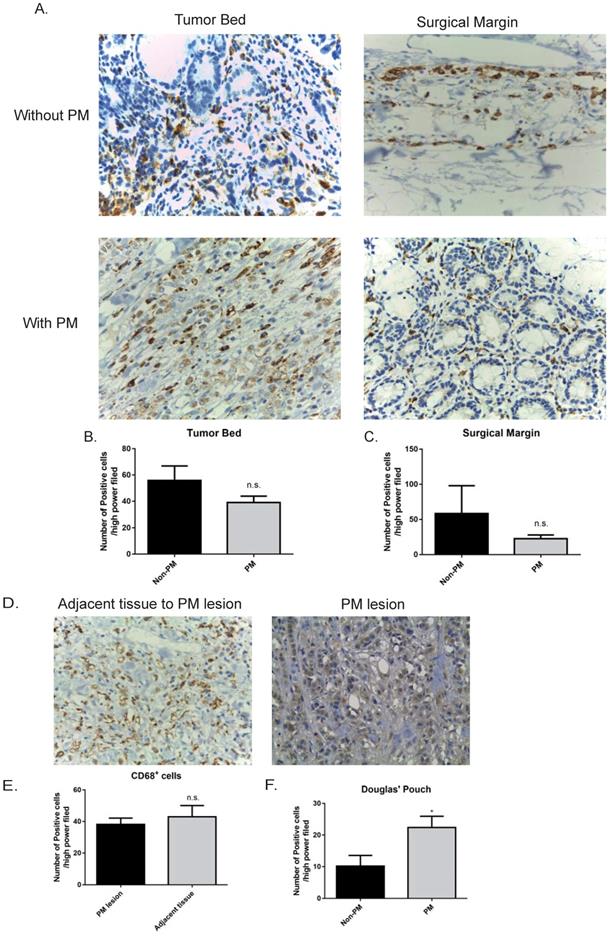 J Cancer Image