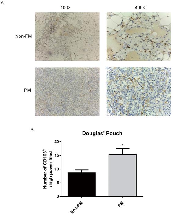 J Cancer Image