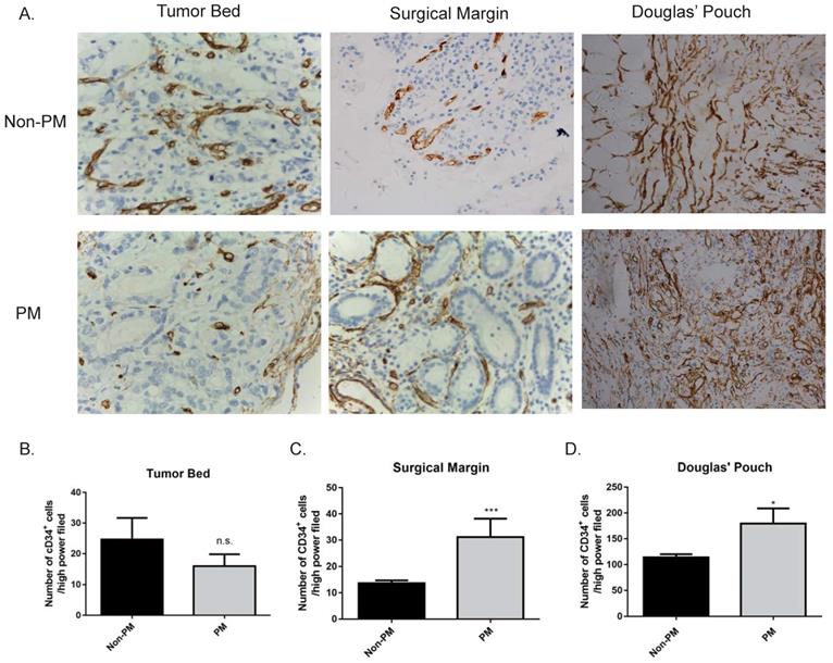 J Cancer Image