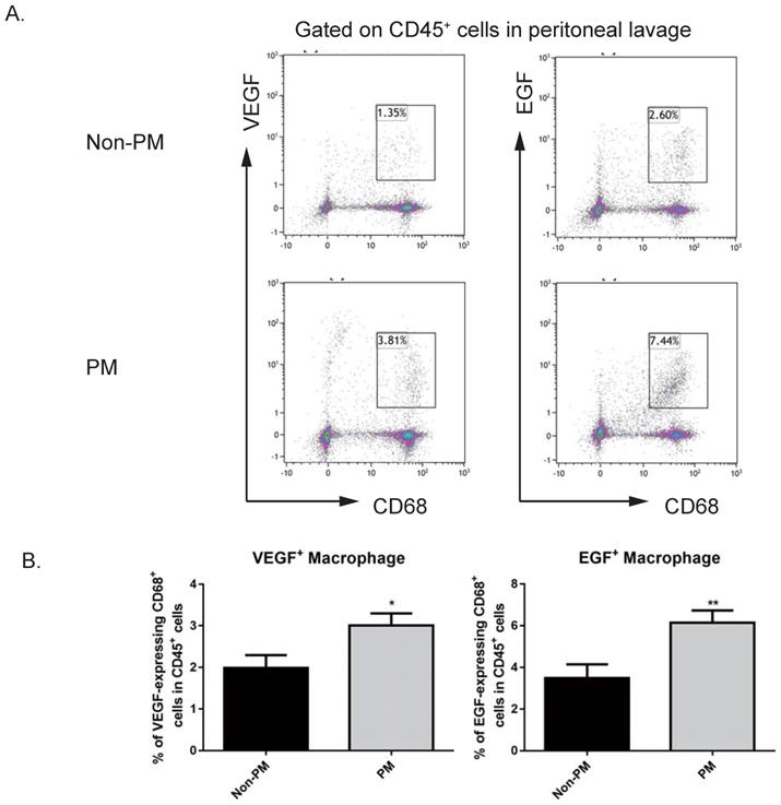 J Cancer Image