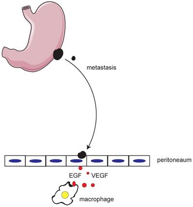 J Cancer Image