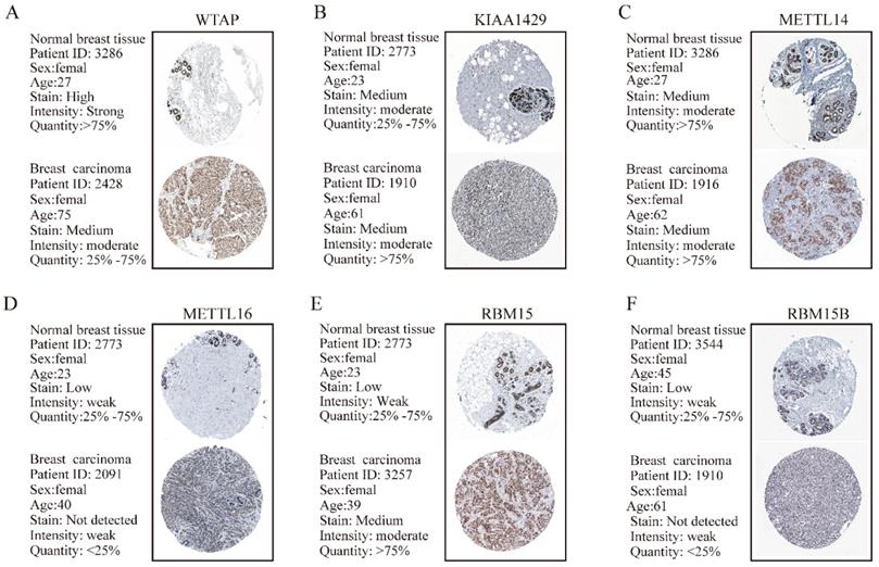 J Cancer Image