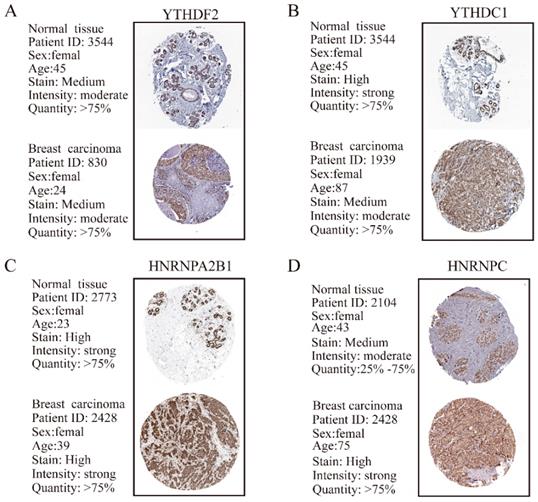 J Cancer Image