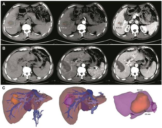 J Cancer Image