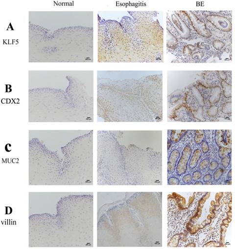 J Cancer Image