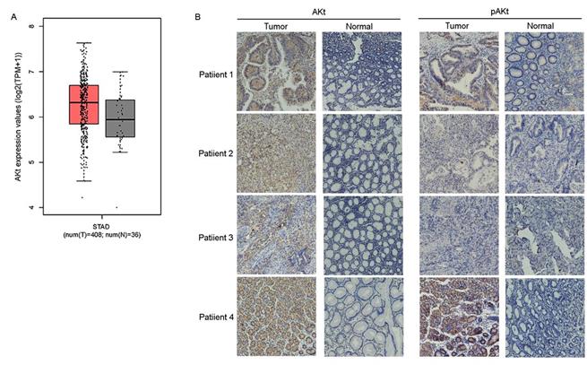 J Cancer Image