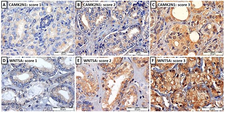 J Cancer Image