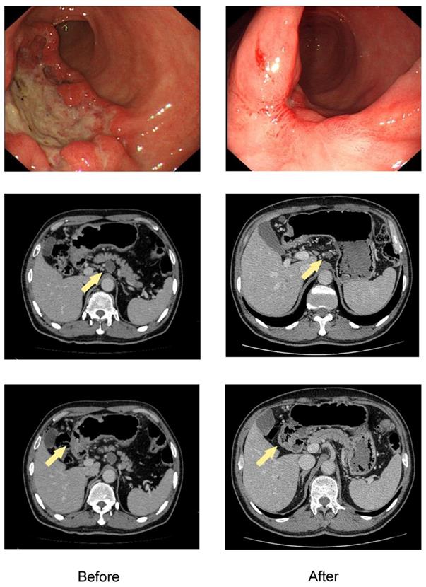 J Cancer Image