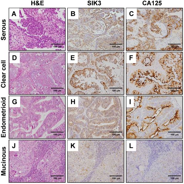 J Cancer Image