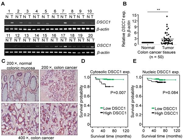 J Cancer Image