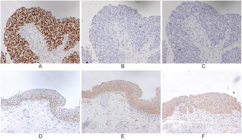 J Cancer Image